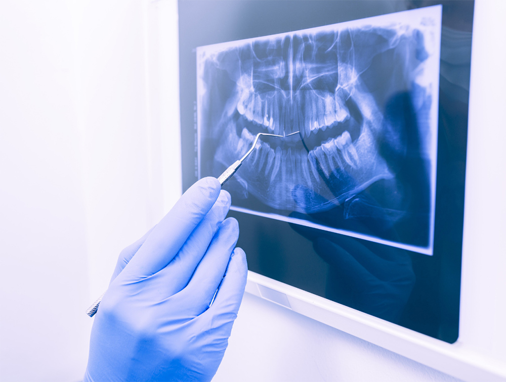 A dentist examining an x-ray of a patient's mouth
